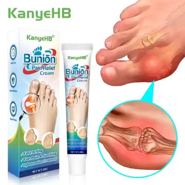 Pommade arthrite | IZICAMER