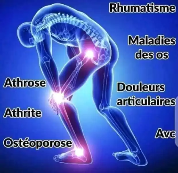 ⭕#Douleurs_articulaires_ou_musculaires_Crampes_Genou_Hanches_AVC_hernie discale #Lombalgies_Nerfs | IZICAMER