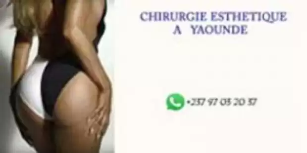 CHIRURGIE ESTHETIQUE AU CAMEROUN