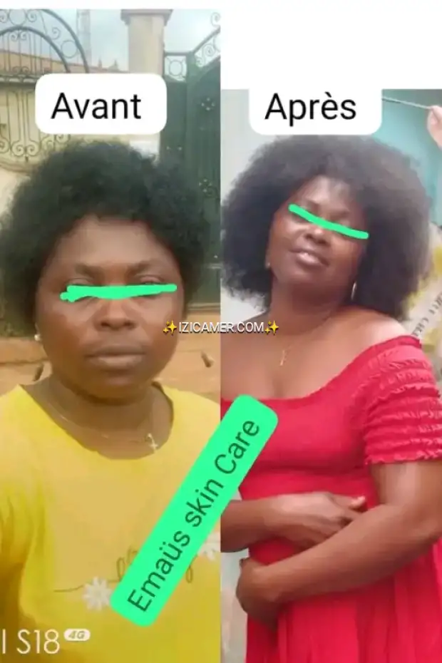 Produits naturels réparateurs anti imperfections | IZICAMER